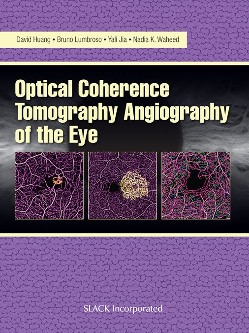 Optical Coherencre Tomography Angiography of the Eye