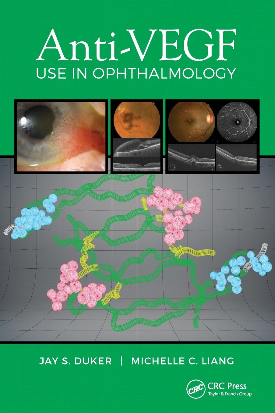 Anti-Vegf Use in Ophthalmology