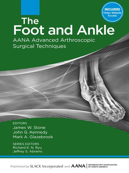 The Foot and Ankle: AANA Advanced Arthroscopic Surgical Techniques