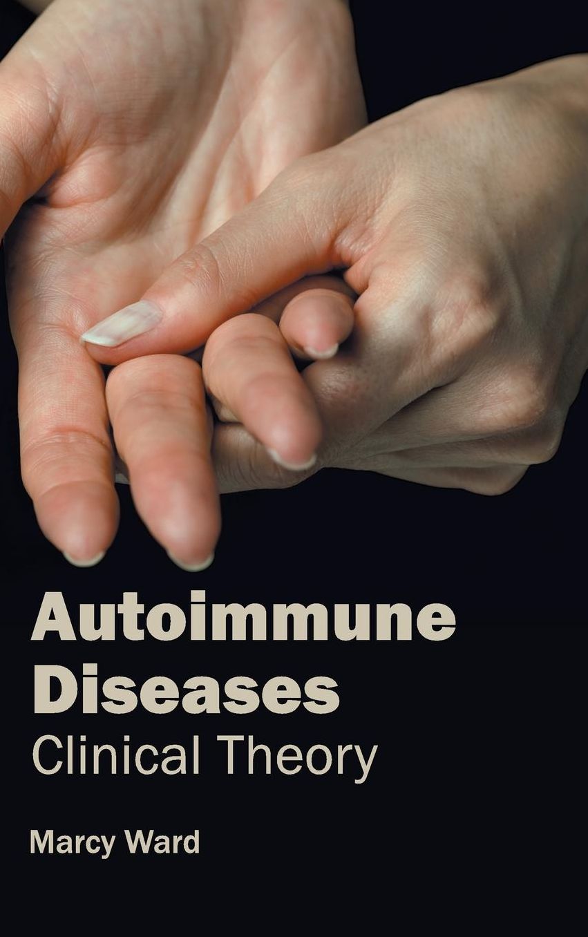 Autoimmune Diseases: Clinical Theory