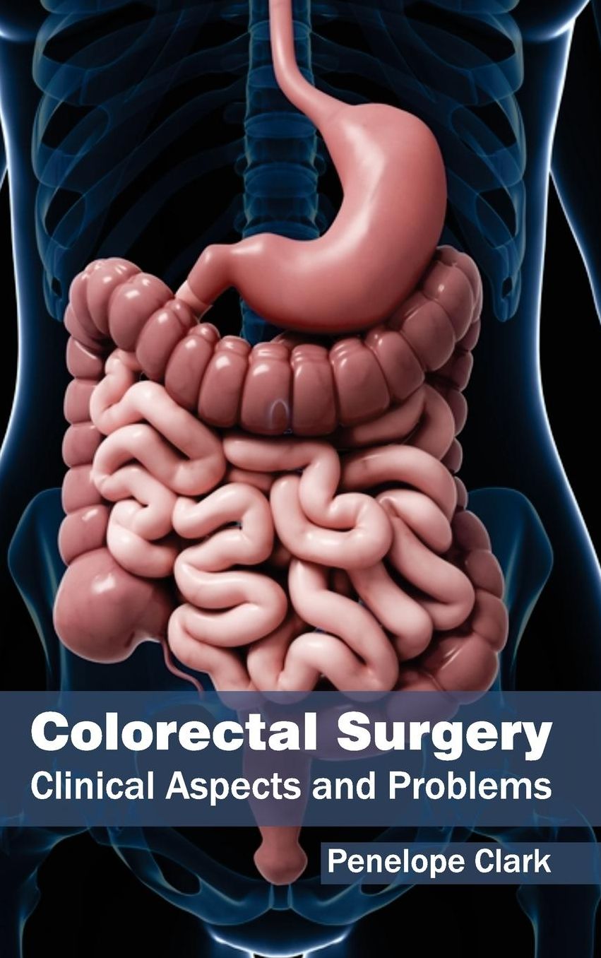 Colorectal Surgery: Clinical Aspects and Problems