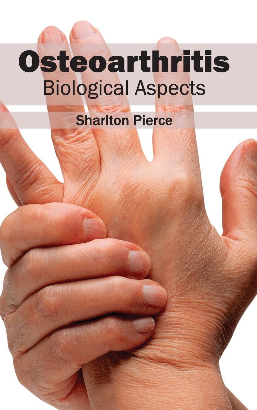 Osteoarthritis: Biological Aspects