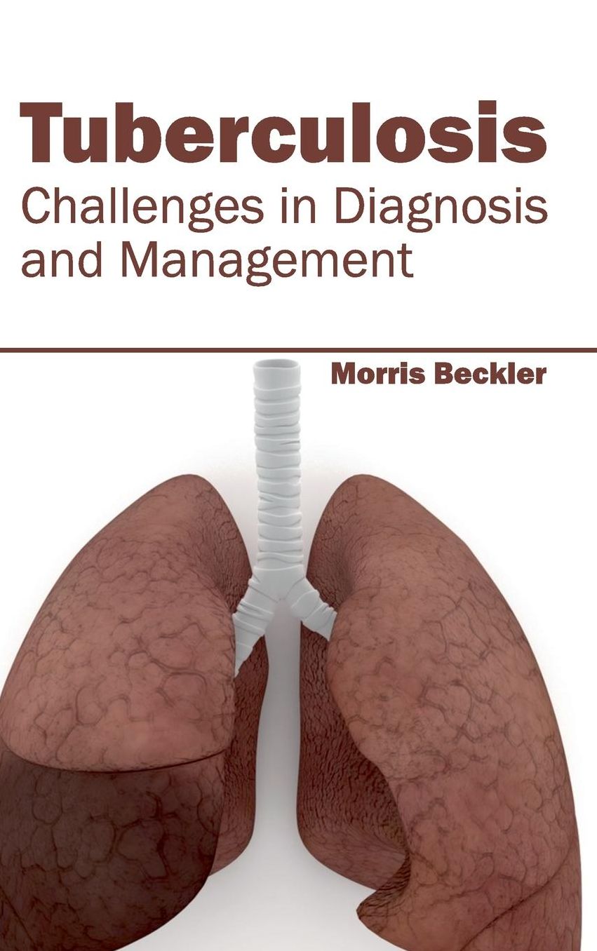 Tuberculosis: Challenges in Diagnosis and Management
