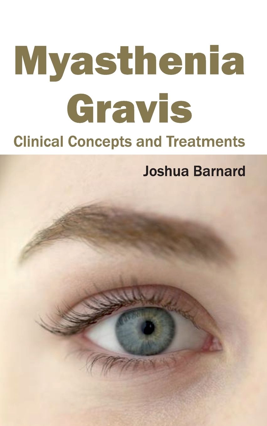 Myasthenia Gravis: Clinical Concepts and Treatments