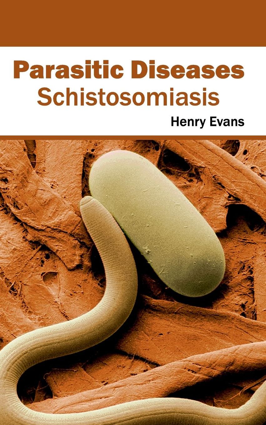 Parasitic Diseases: Schistosomiasis