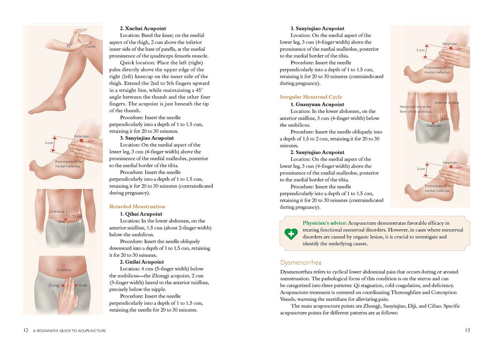 A Beginner's Guide to Acupuncture: Treating Common Ailments through Traditional Chinese Medicine