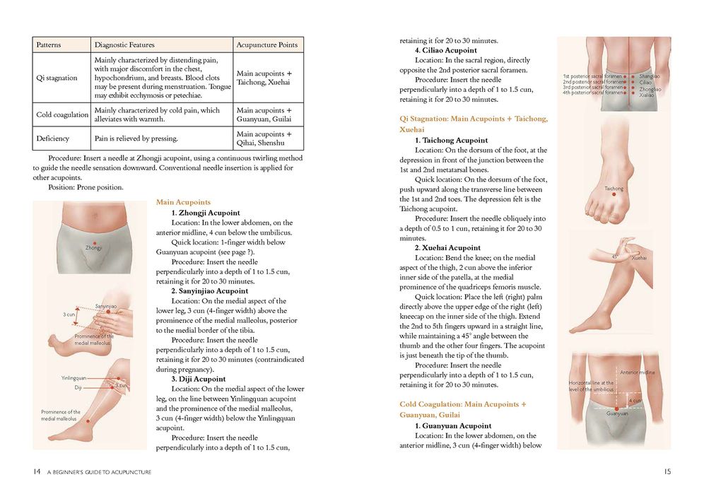 A Beginner's Guide to Acupuncture: Treating Common Ailments through Traditional Chinese Medicine
