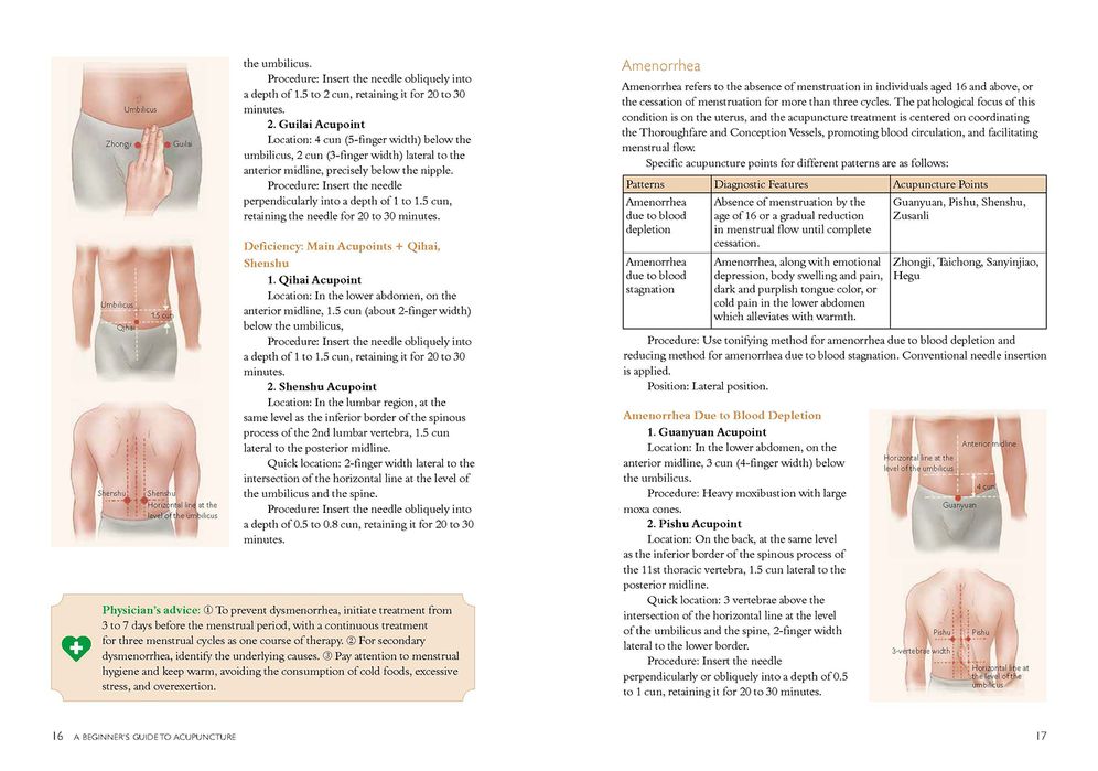 A Beginner's Guide to Acupuncture: Treating Common Ailments through Traditional Chinese Medicine