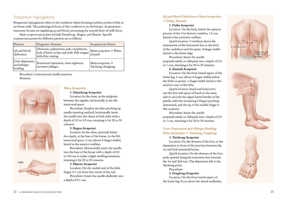 A Beginner's Guide to Acupuncture: Treating Common Ailments through Traditional Chinese Medicine