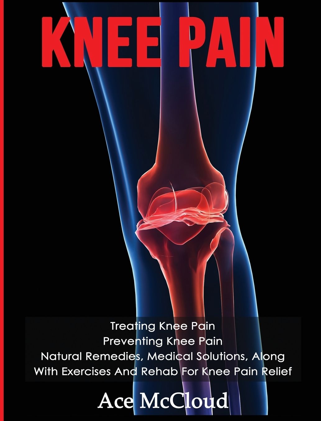 Knee Pain: Treating Knee Pain: Preventing Knee Pain: Natural Remedies, Medical Solutions, Along With Exercises And Rehab For Knee Pain Relief