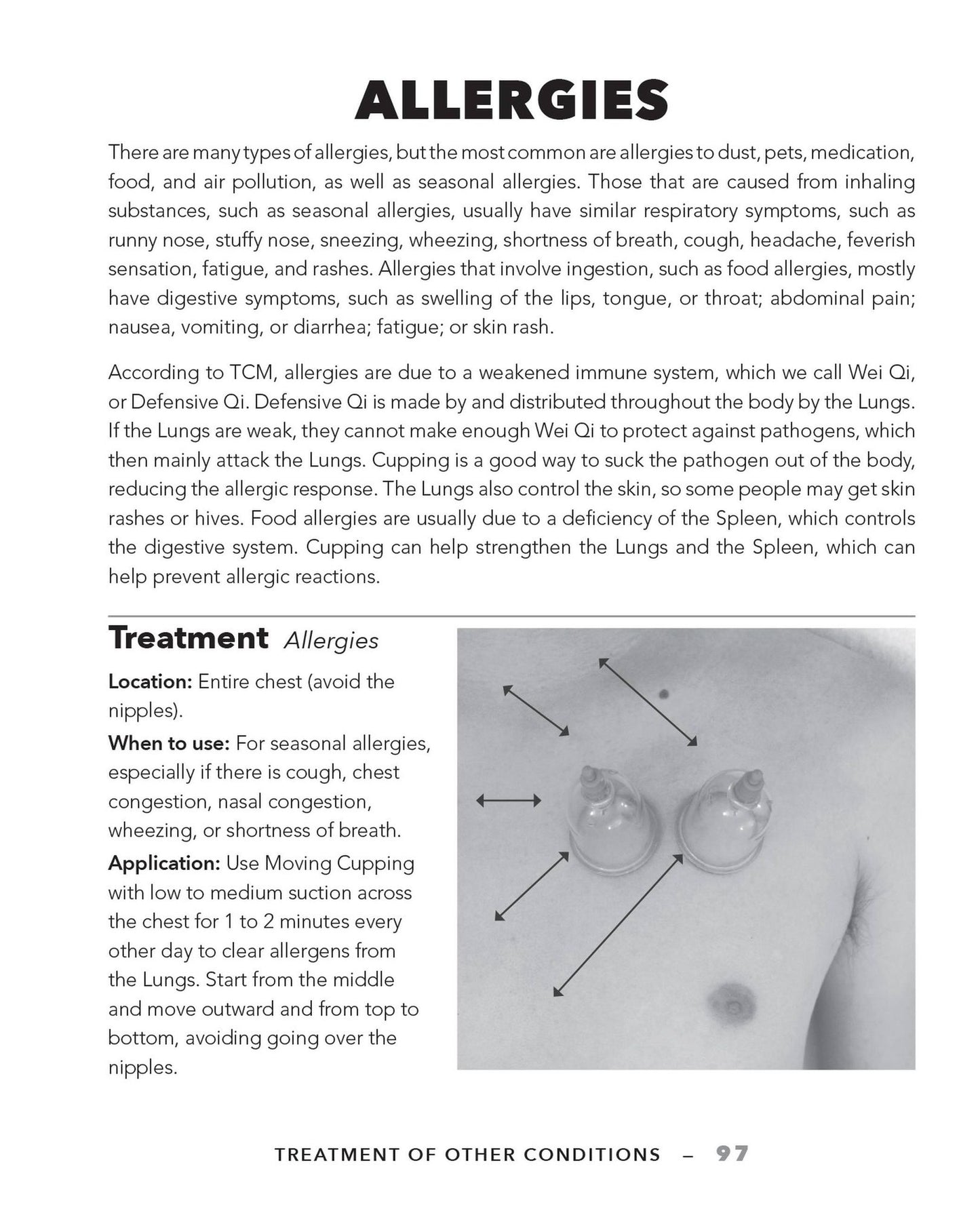 Cupping Therapy for Muscles and Joints: An Easy-to-Understand Guide for Relieving Pain, Reducing Inflammation and Healing Injury