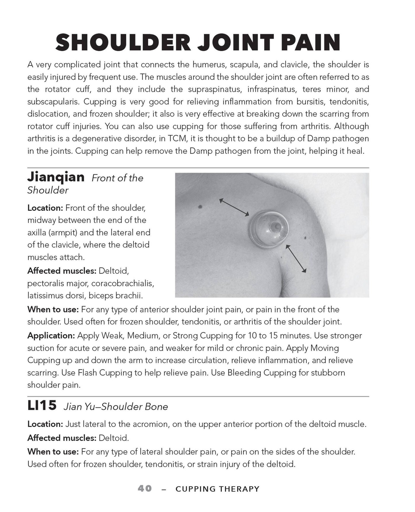 Cupping Therapy for Muscles and Joints: An Easy-to-Understand Guide for Relieving Pain, Reducing Inflammation and Healing Injury