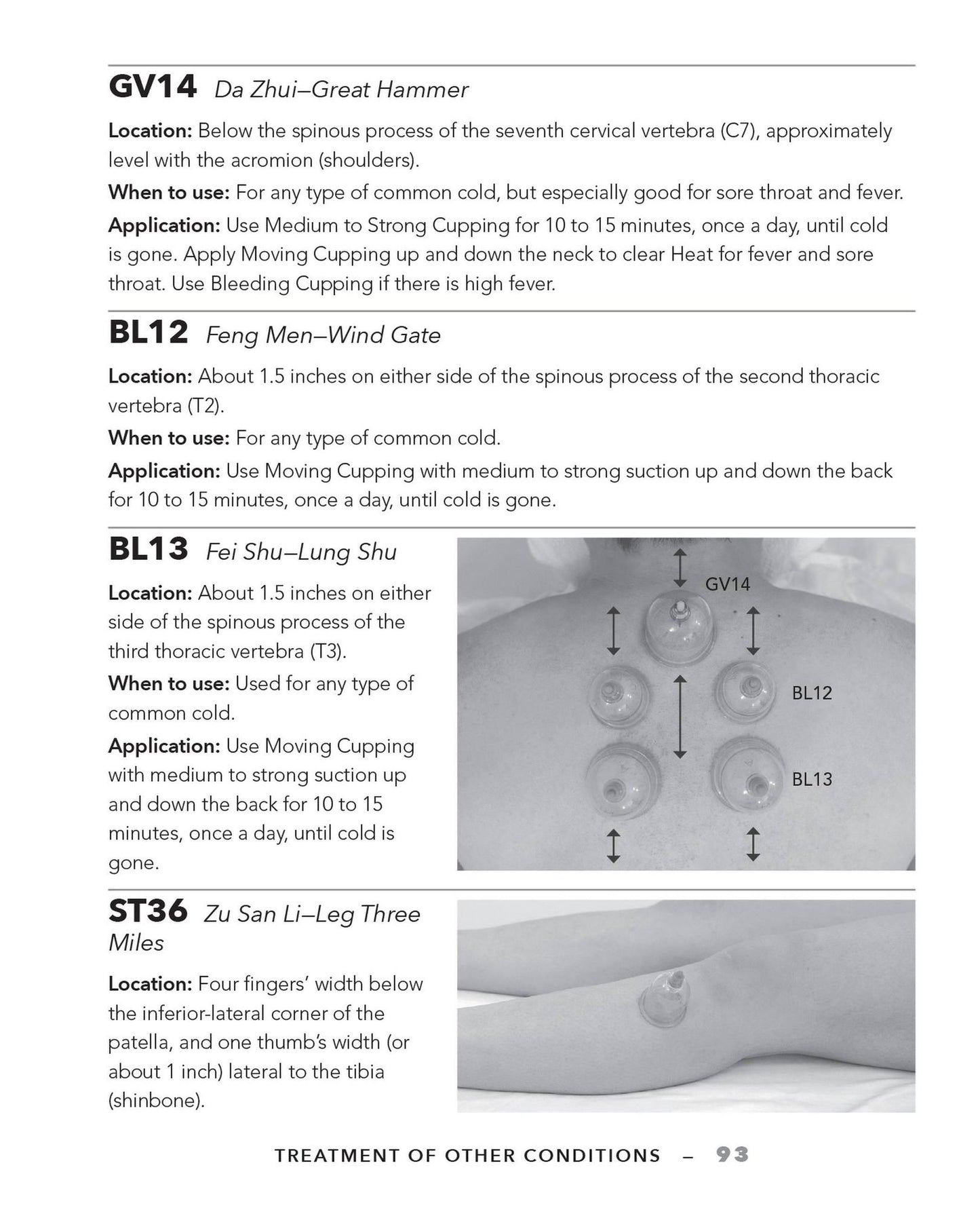 Cupping Therapy for Muscles and Joints: An Easy-to-Understand Guide for Relieving Pain, Reducing Inflammation and Healing Injury
