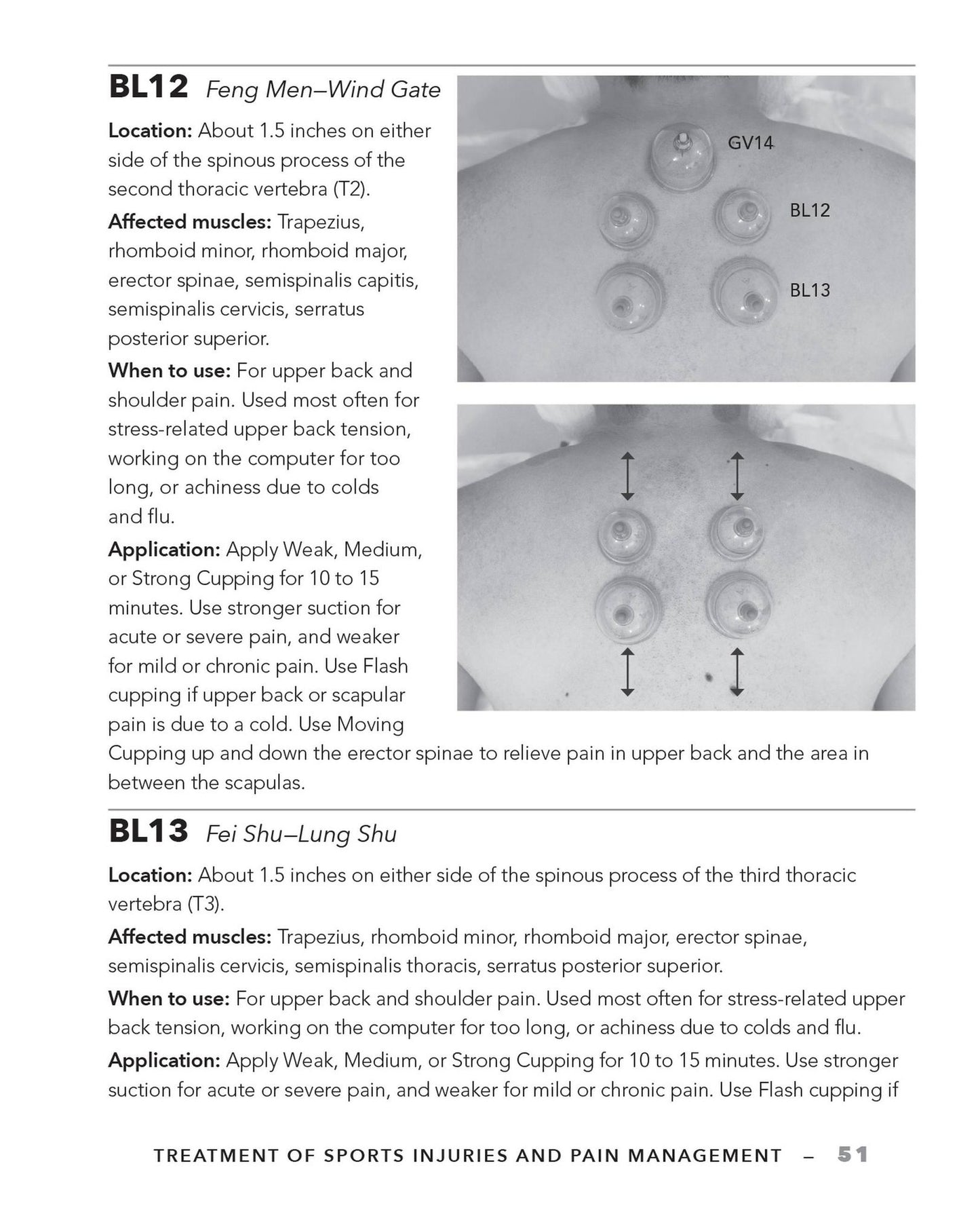 Cupping Therapy for Muscles and Joints: An Easy-to-Understand Guide for Relieving Pain, Reducing Inflammation and Healing Injury
