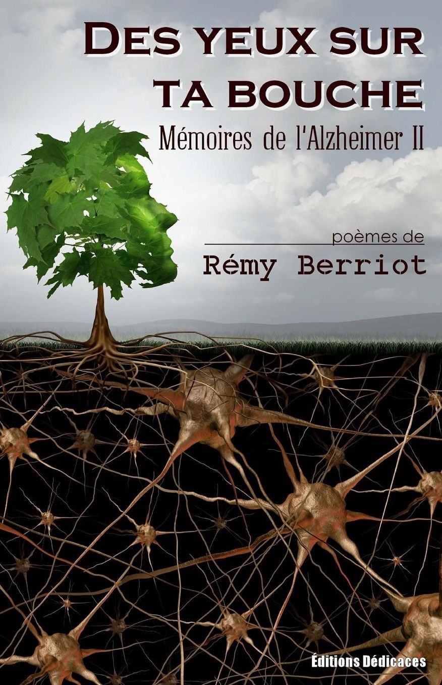 Des yeux sur ta bouche: M moires de l'Alzheimer II
