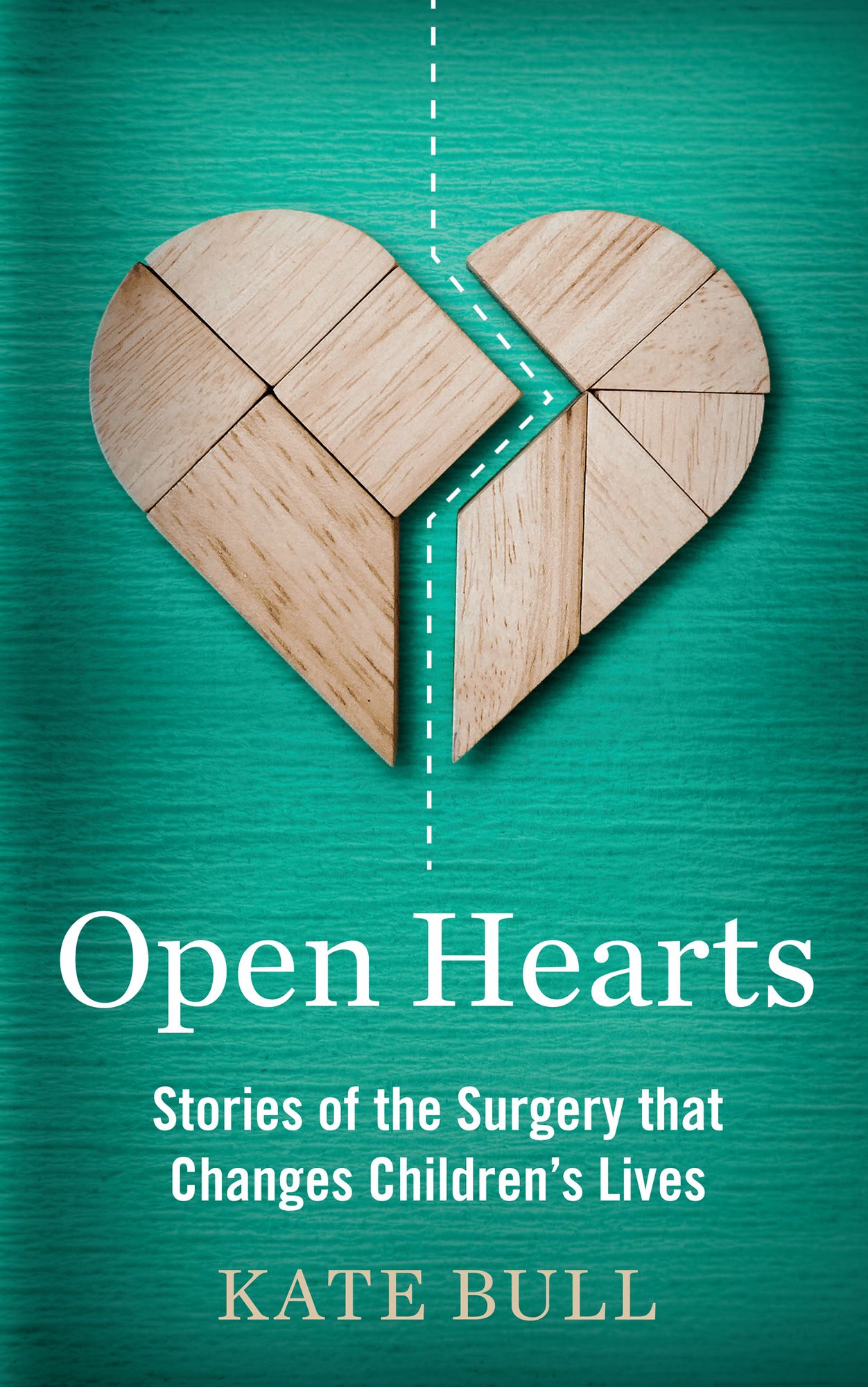 Open Hearts: Stories of the Surgery That Changes Children's Lives