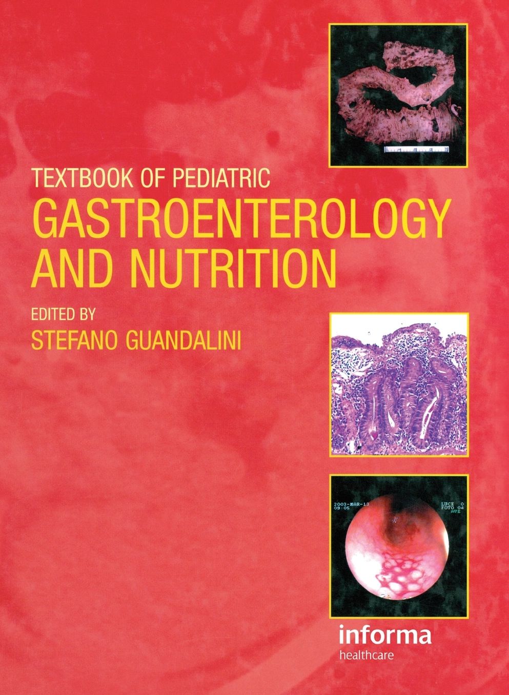 Textbook of Pediatric Gastroenterology