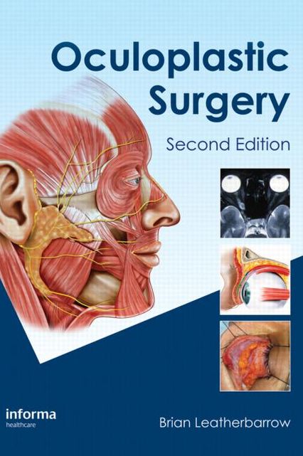 Oculoplastic Surgery, Second Edition