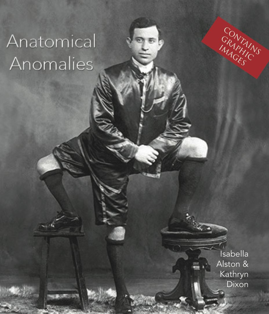 Anatomical Anomalies