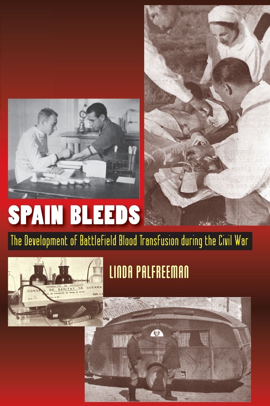 Spain Bleeds: The Development of Battlefield Blood Transfusion During the Civil War