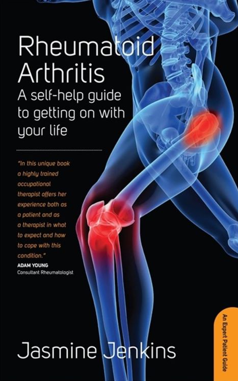 Rheumatoid Arthritis