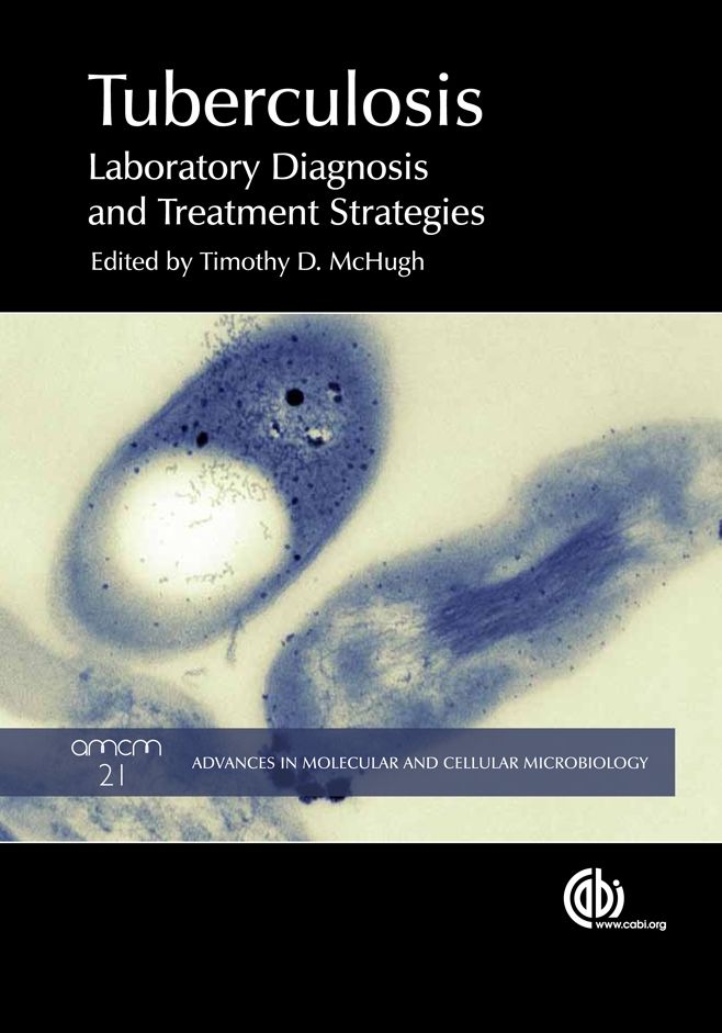 Tuberculosis: Diagnosis and Treatment