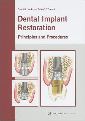 Dental Implant Restoration: Principles and Procedures