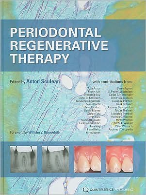 Periodontal Regenerative Therapy