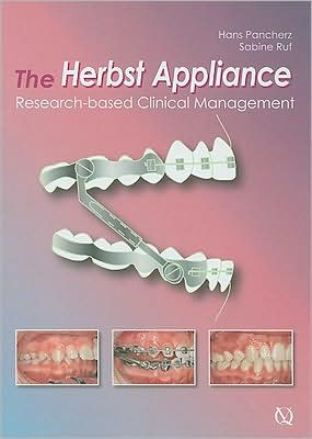 The Herbst Appliance: Research-Based Clinical Management
