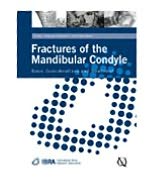 Fractures of the Mandibular Condyle: Basic Considerations and Treatment