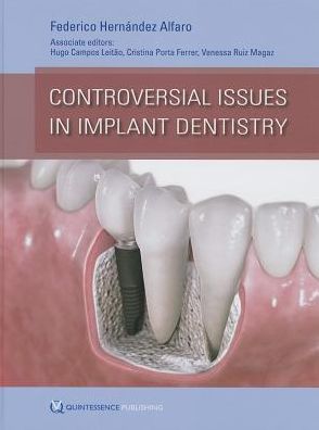 Controversial Issues in Implant Dentistry