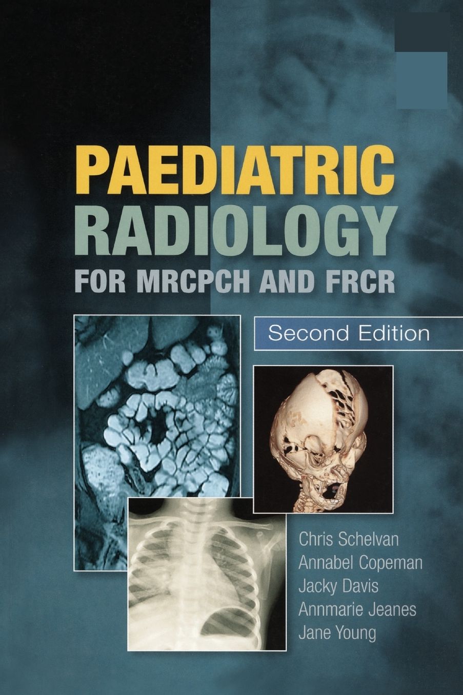 Paediatric Radiology for MRCPCH and FRCR, second edition