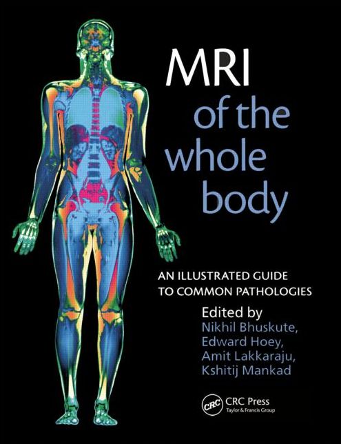 MRI of the Whole Body: An Illustrated Guide for Common Pathologies