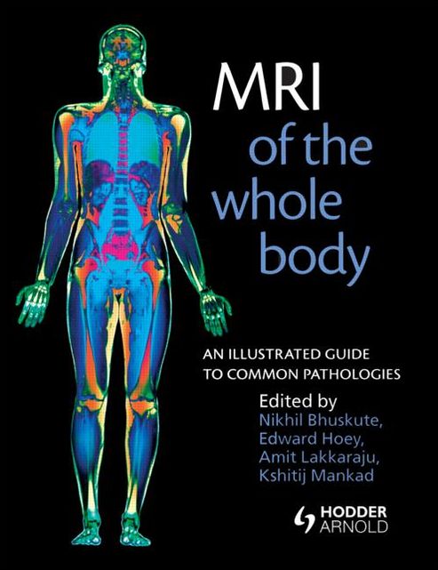 MRI of the Whole Body: An Illustrated Guide for Common Pathologies