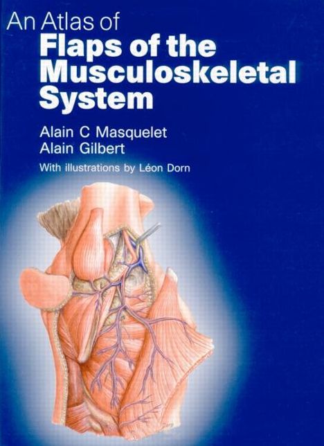 An Atlas of Flaps of the Musculoskeletal System