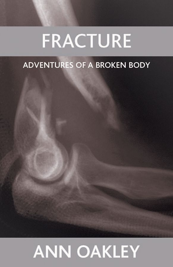 Fracture: Adventures of a Broken Body