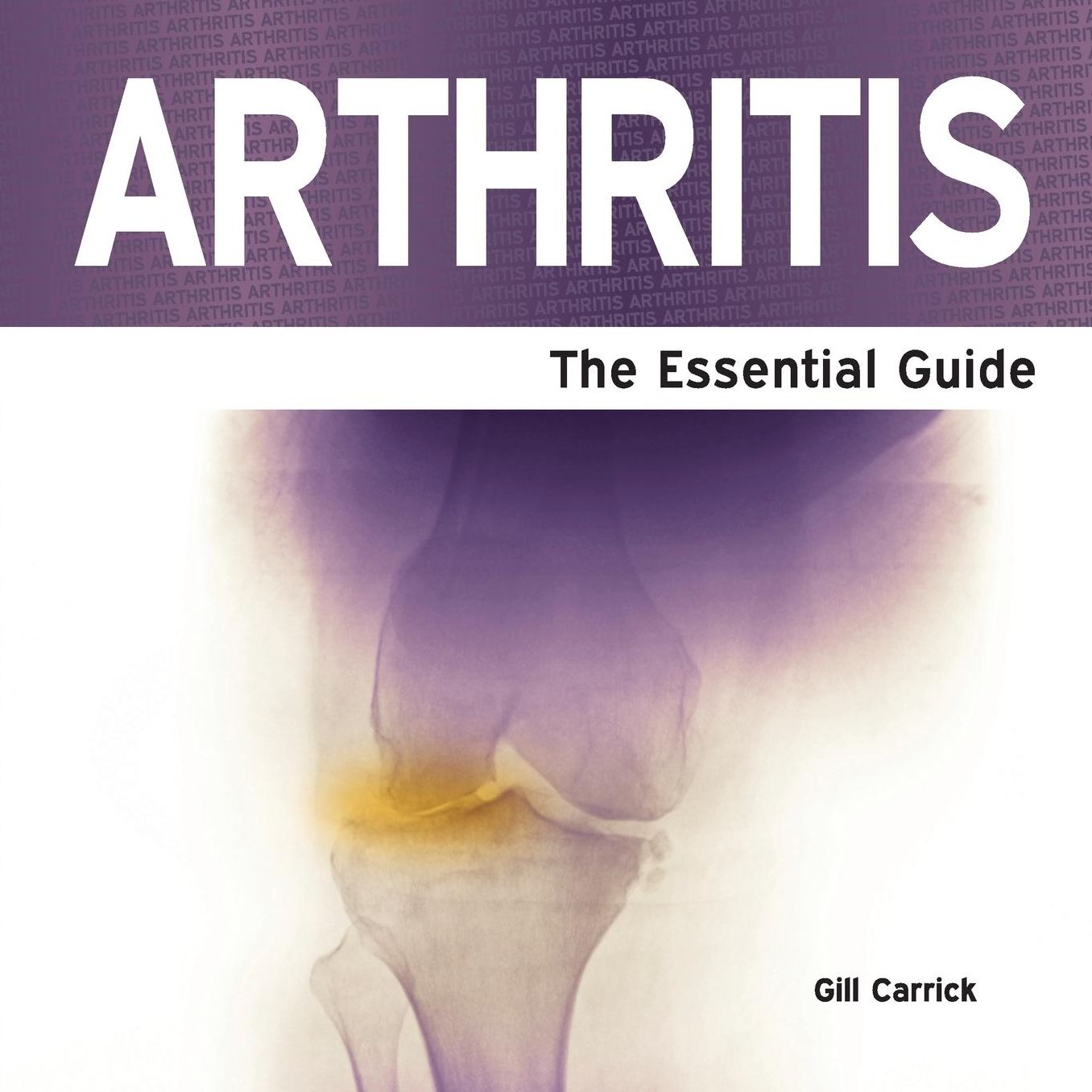 Arthritis - The Essential Guide
