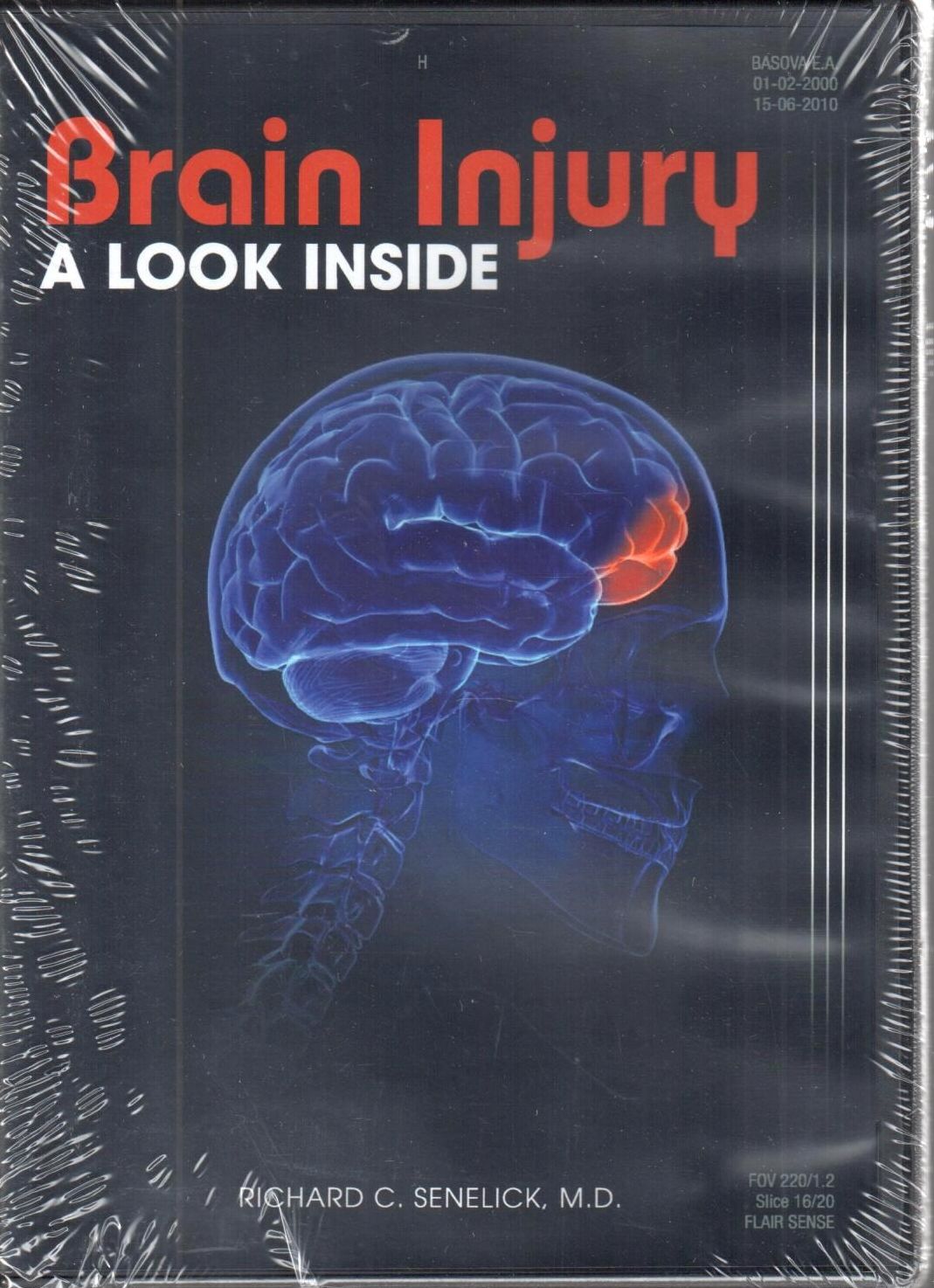 Brain Injury DVD: A Look Inside