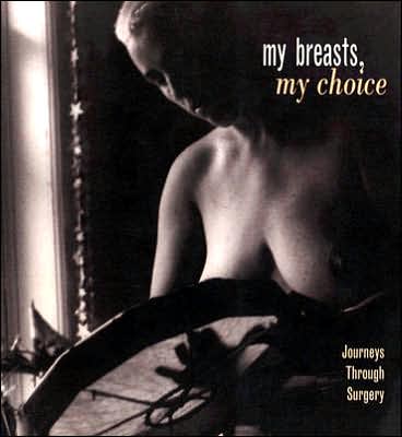 My Breasts, My Choice: Journeys Through Surgery
