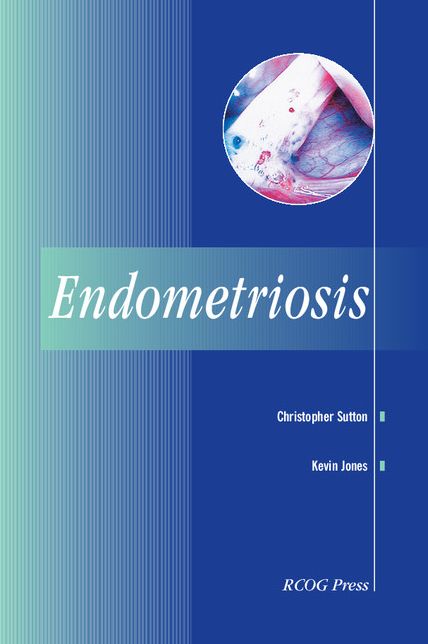 Endometriosis