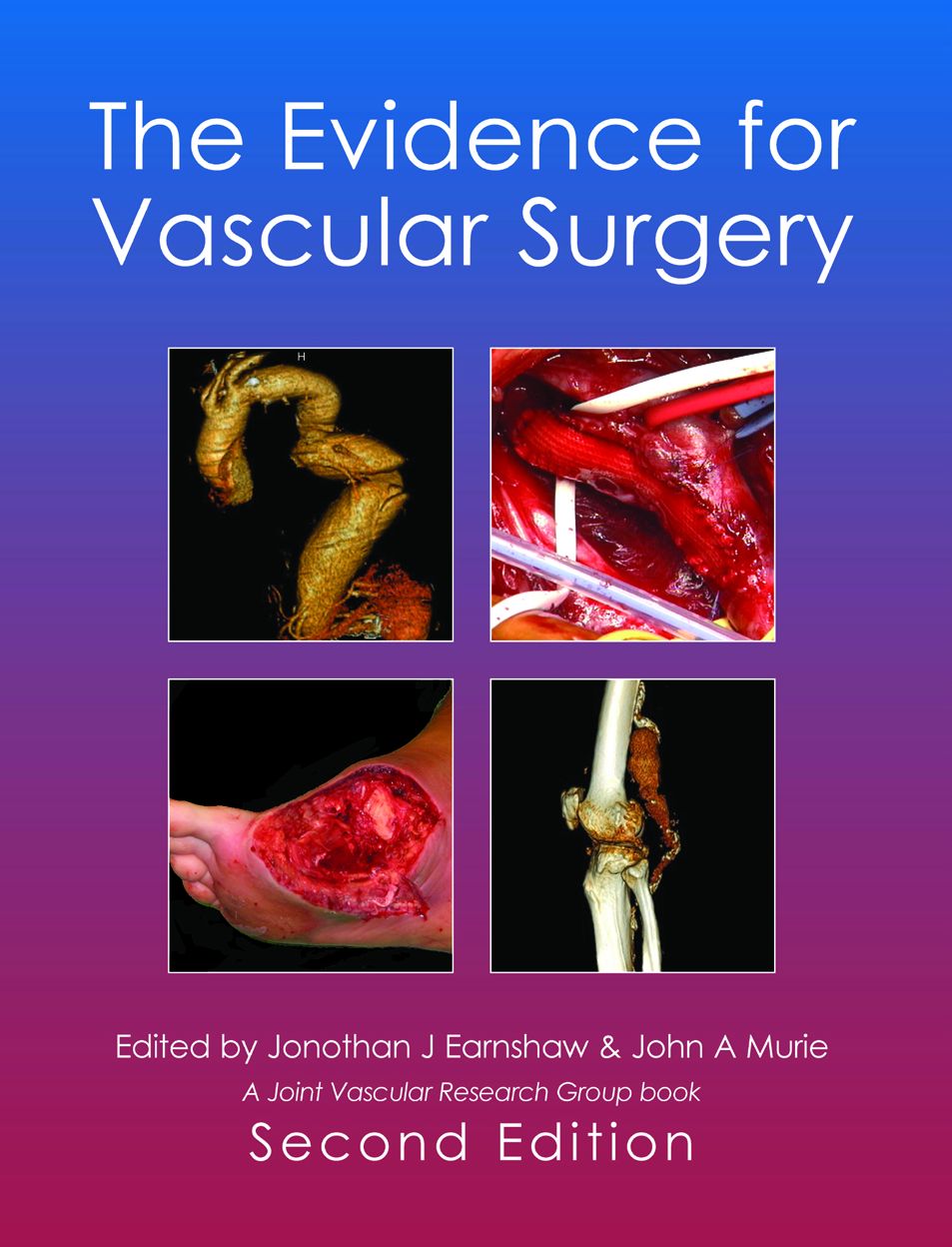 The Evidence for Vascular Surgery