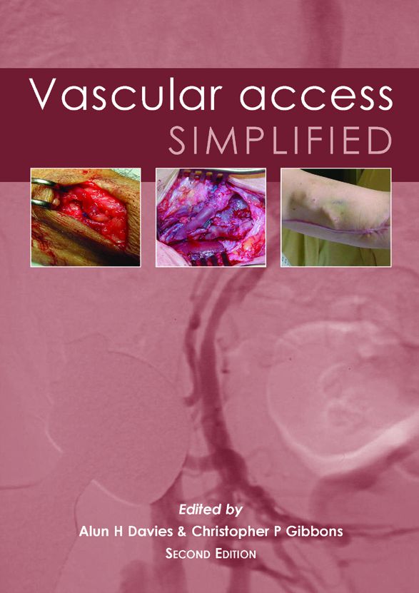 Vascular Access Simplified