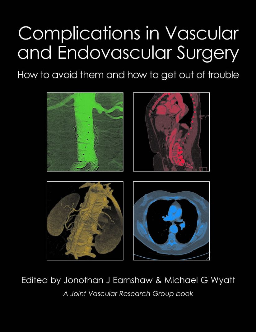 Complications in Vascular and Endovascular Surgery: How to Avoid Them and How to Get Out of Trouble