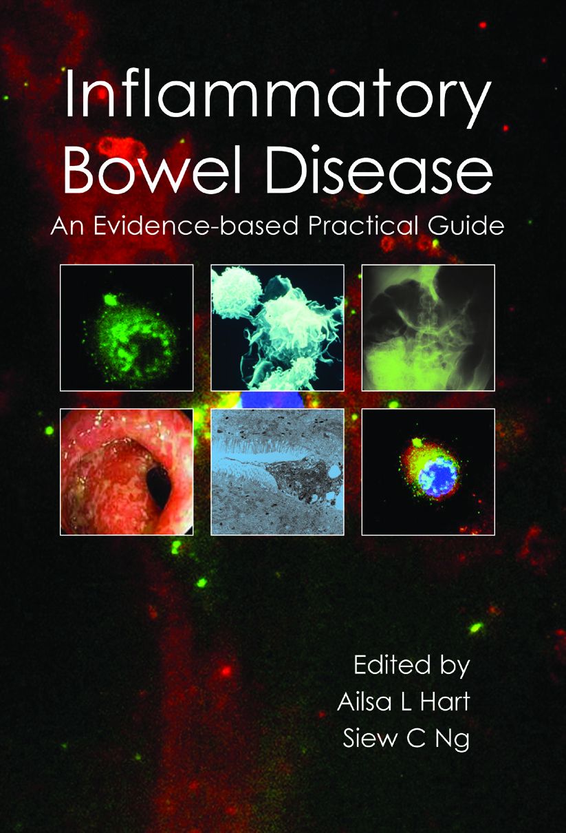 Inflammatory Bowel Disease : An Evidence-Based Practical Guide