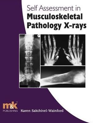 Self-Assessment in Musculoskeletal Pathology X-Rays