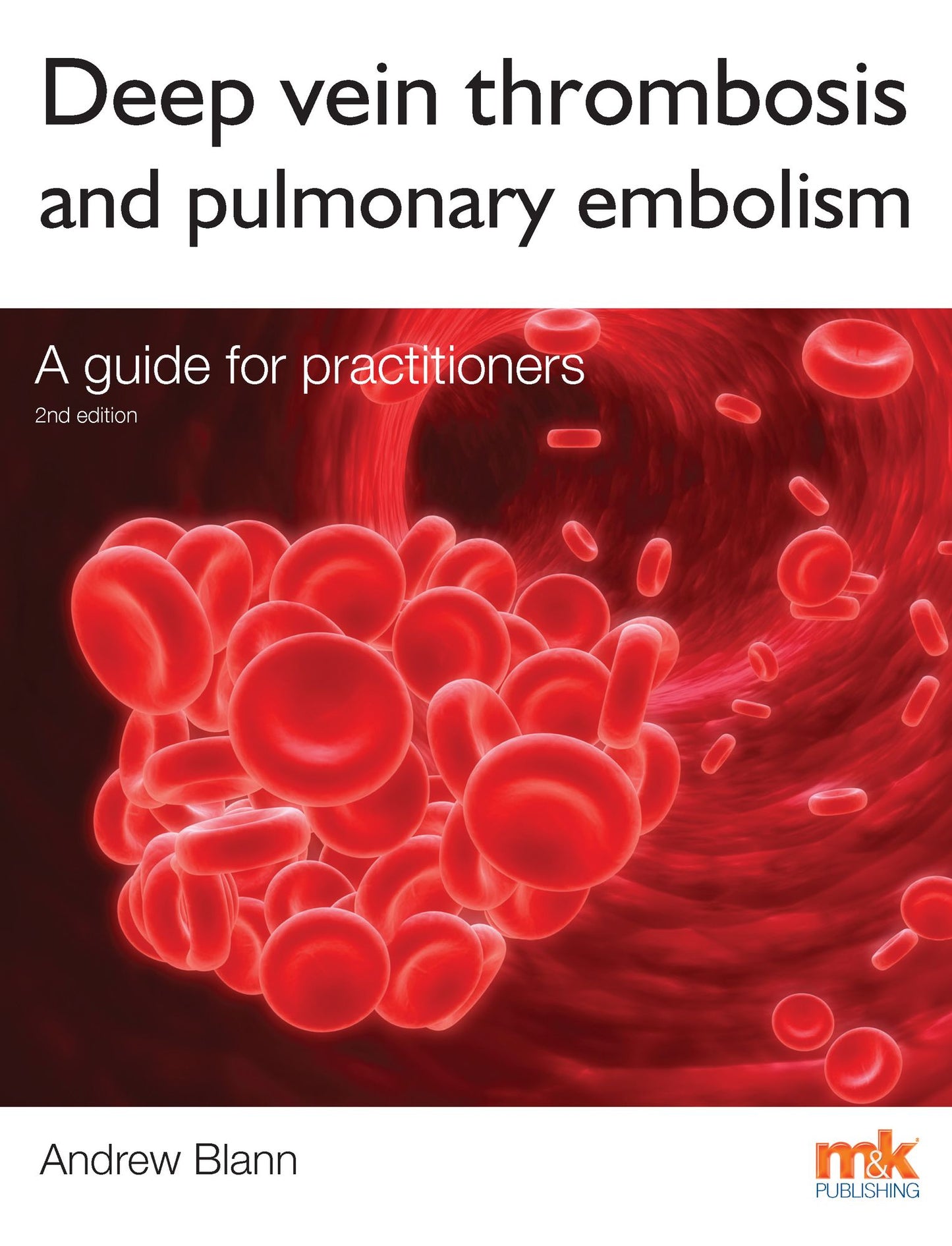 Deep Vein Thrombosis and Pulmonary Embolism: