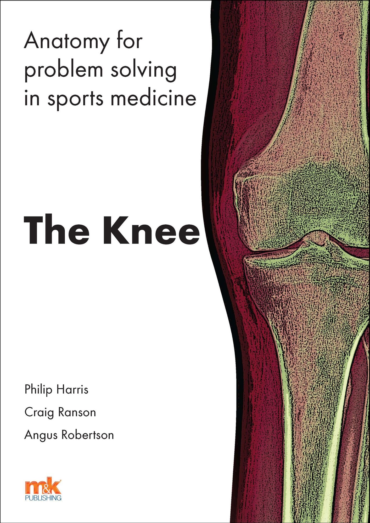 Anatomy for problem solving in sports medicine: The Knee