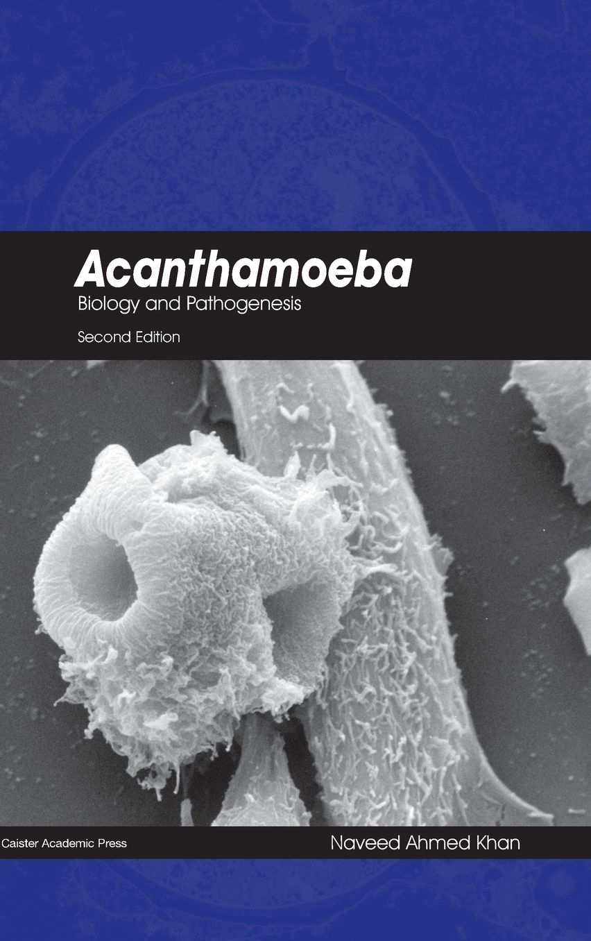 Acanthamoeba: Biology and Pathogenesis