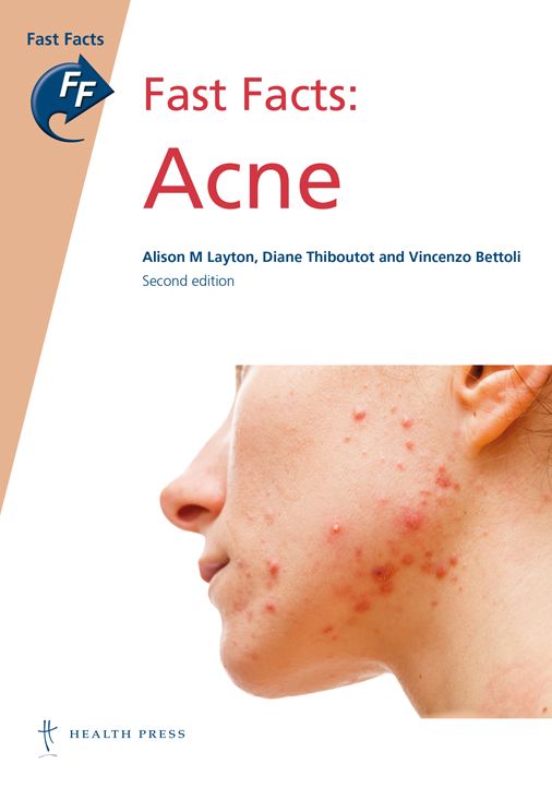 Fast Facts: Acne