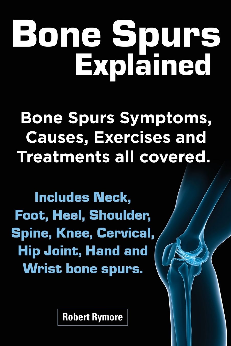 Bone Spurs Explained. Bone Spurs Symptoms, Causes, Exercises and Treatments All Covered. Includes Neck, Foot, Heel, Shoulder, Spine, Knee, Cervical, H